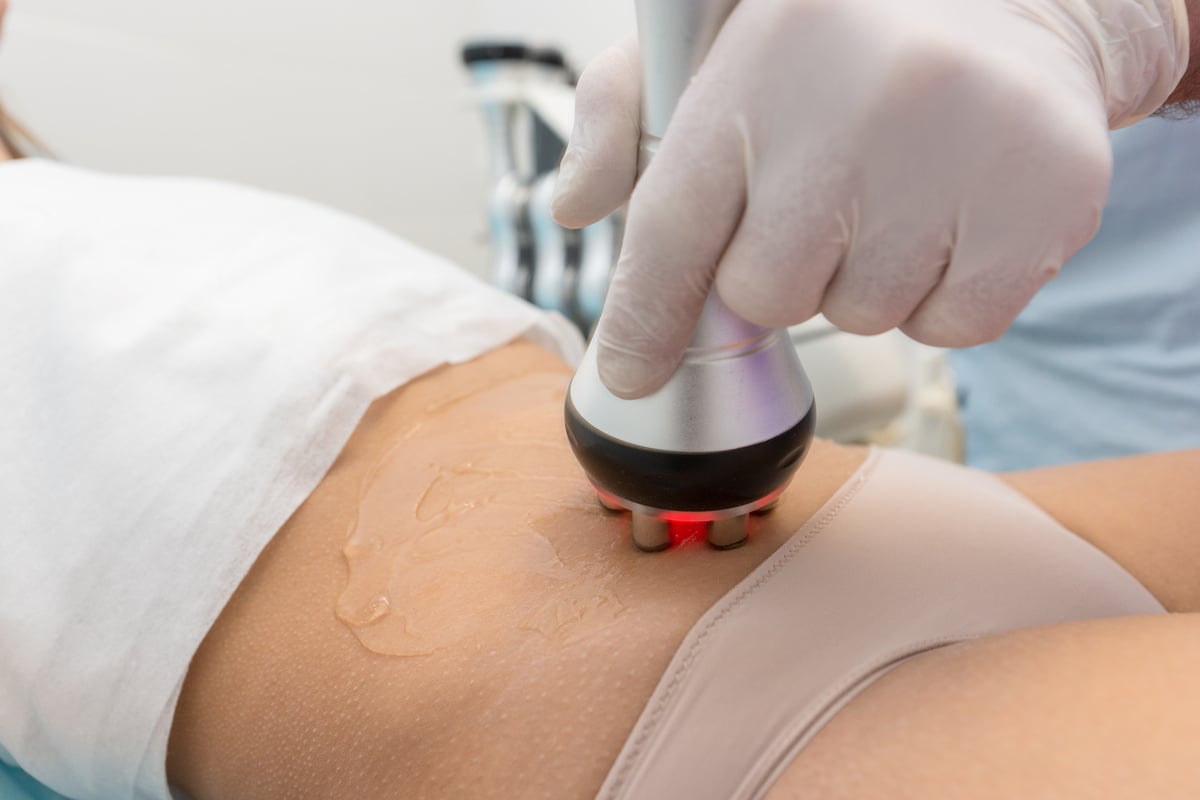 Radio frequency skin tightening, belly. Female body, cosmetology procedure.